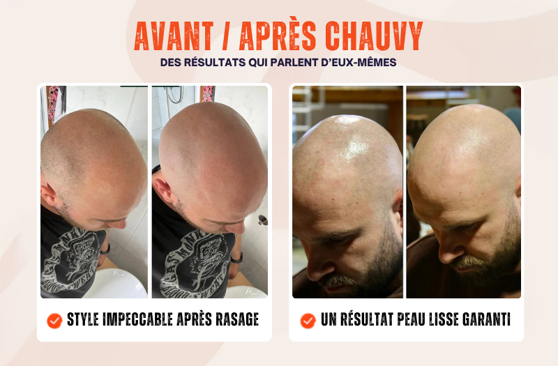 Kit de Rasage CHAUVY™